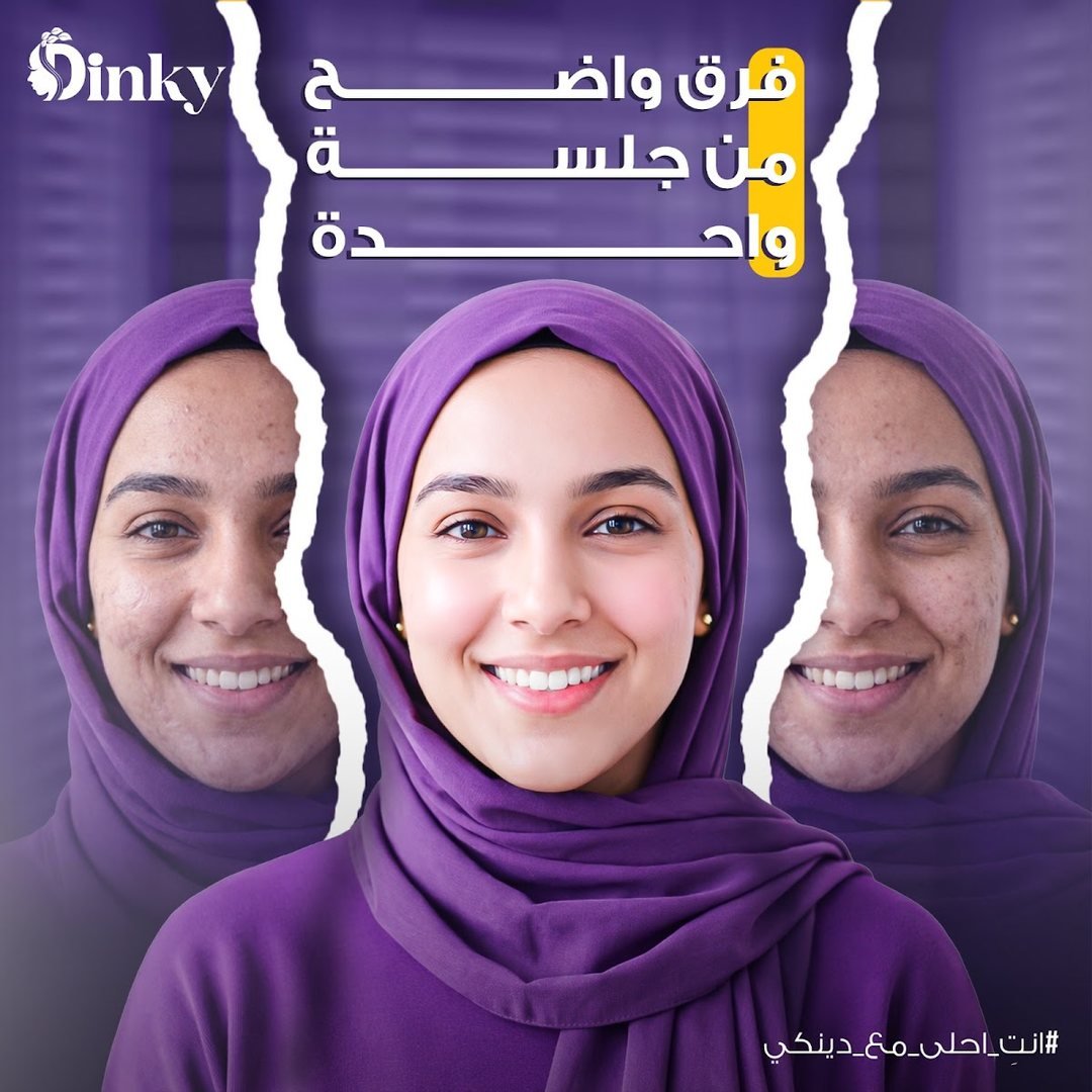 تصميم Dinky 10
