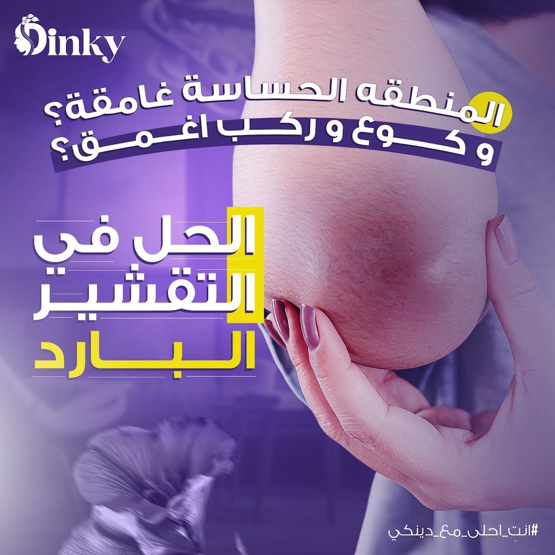 تصميم Dinky 23