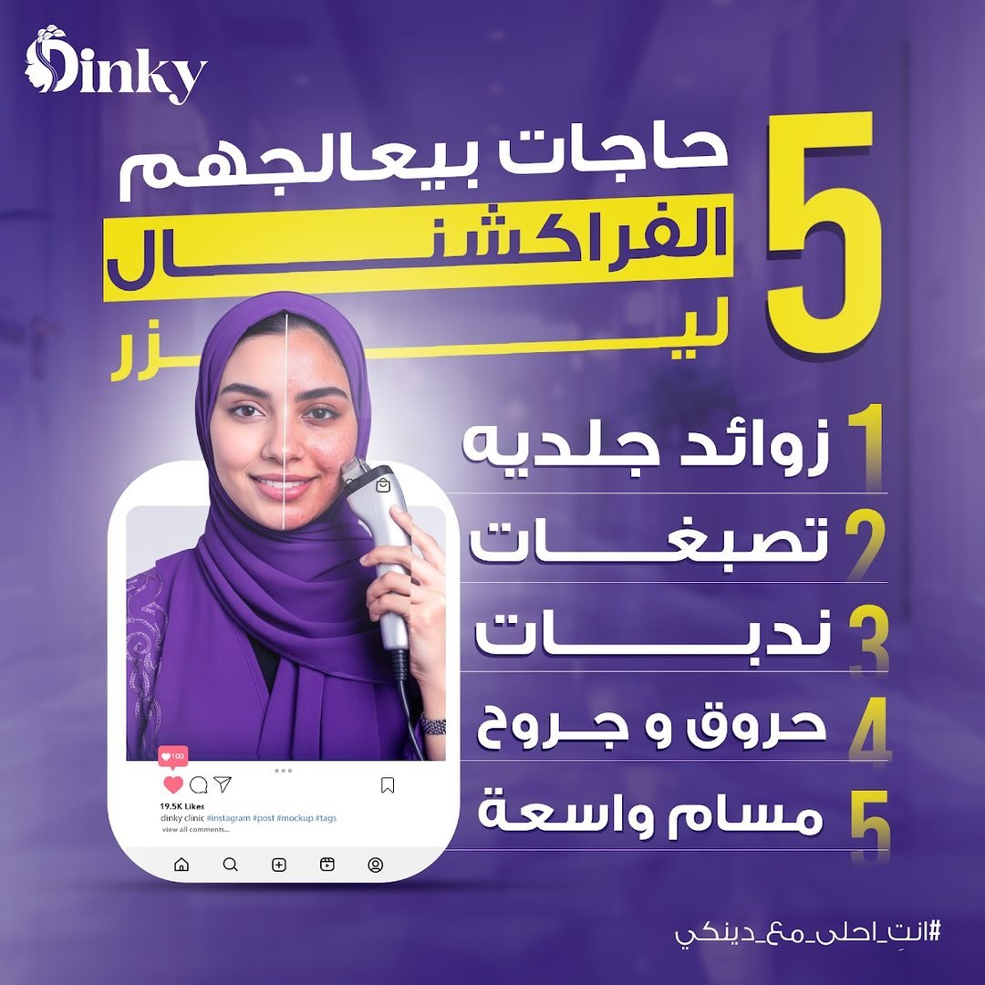 تصميم Dinky 24