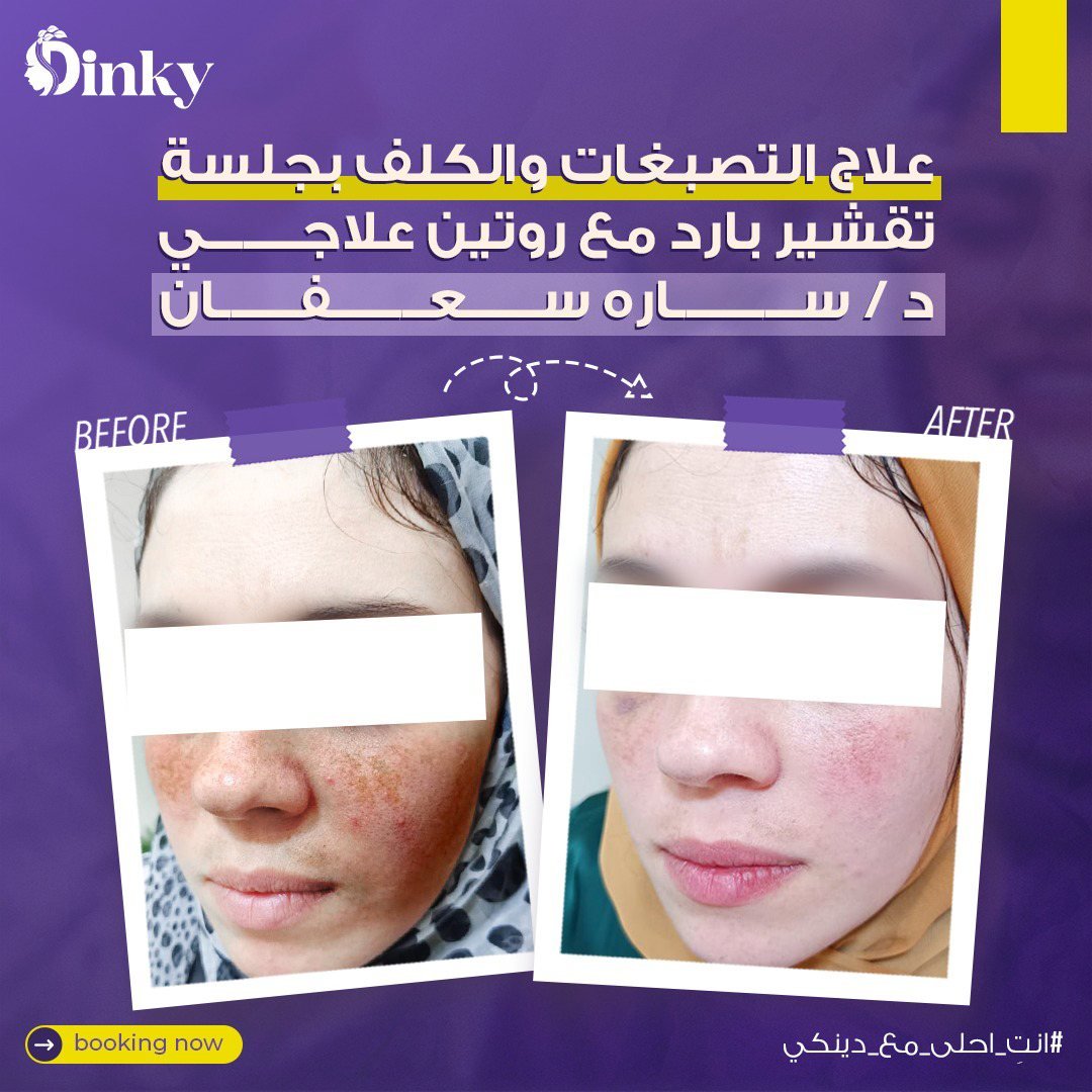 تصميم Dinky 29